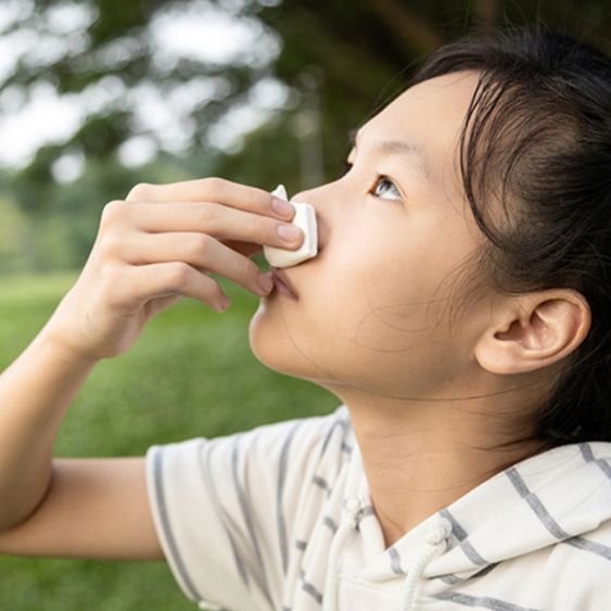 Allergic Rhinitis