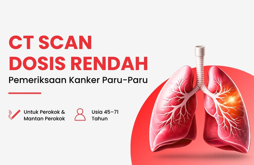 Paket Kardio Premium Plus